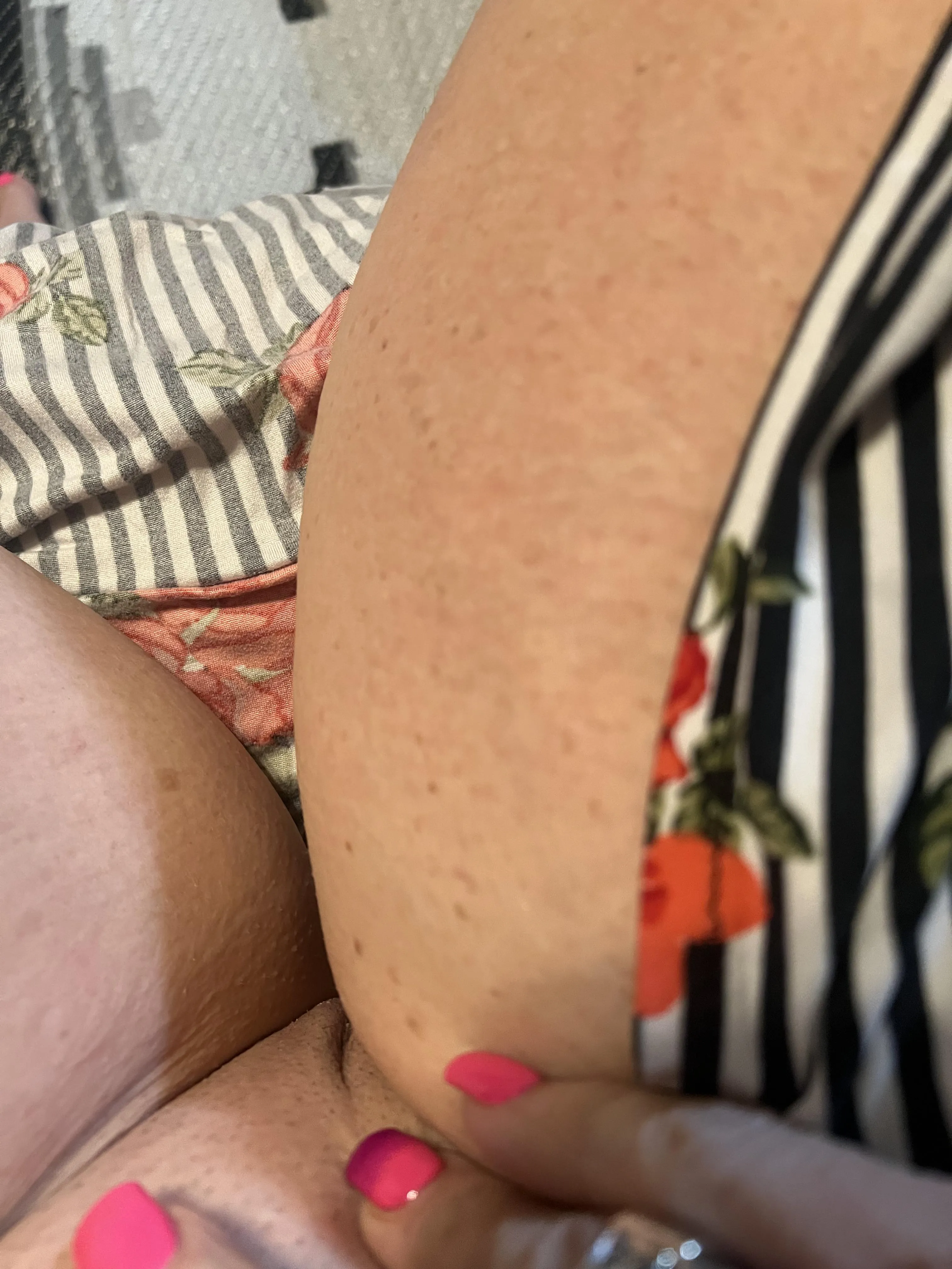 Pick your favorite freckle and let me know