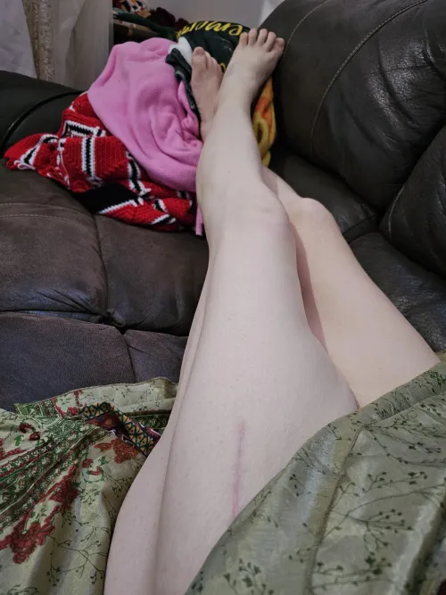 Yes, they are that long and no, there is nothing under the skirt except skin