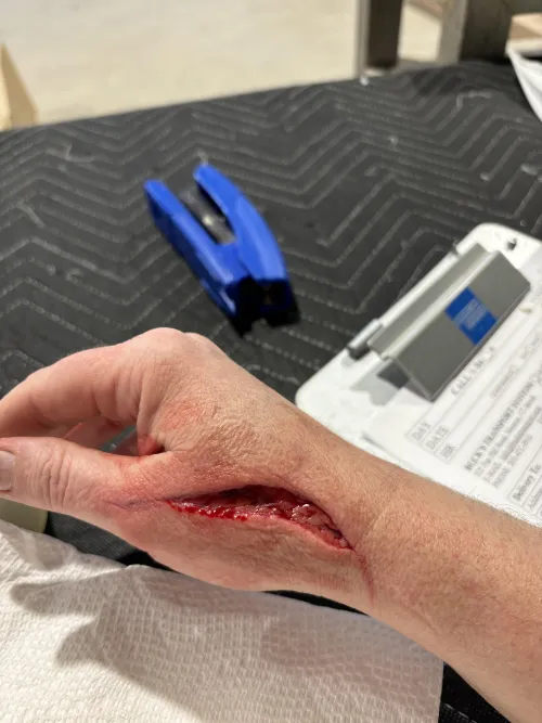 Cut my hand with a box cutter at work