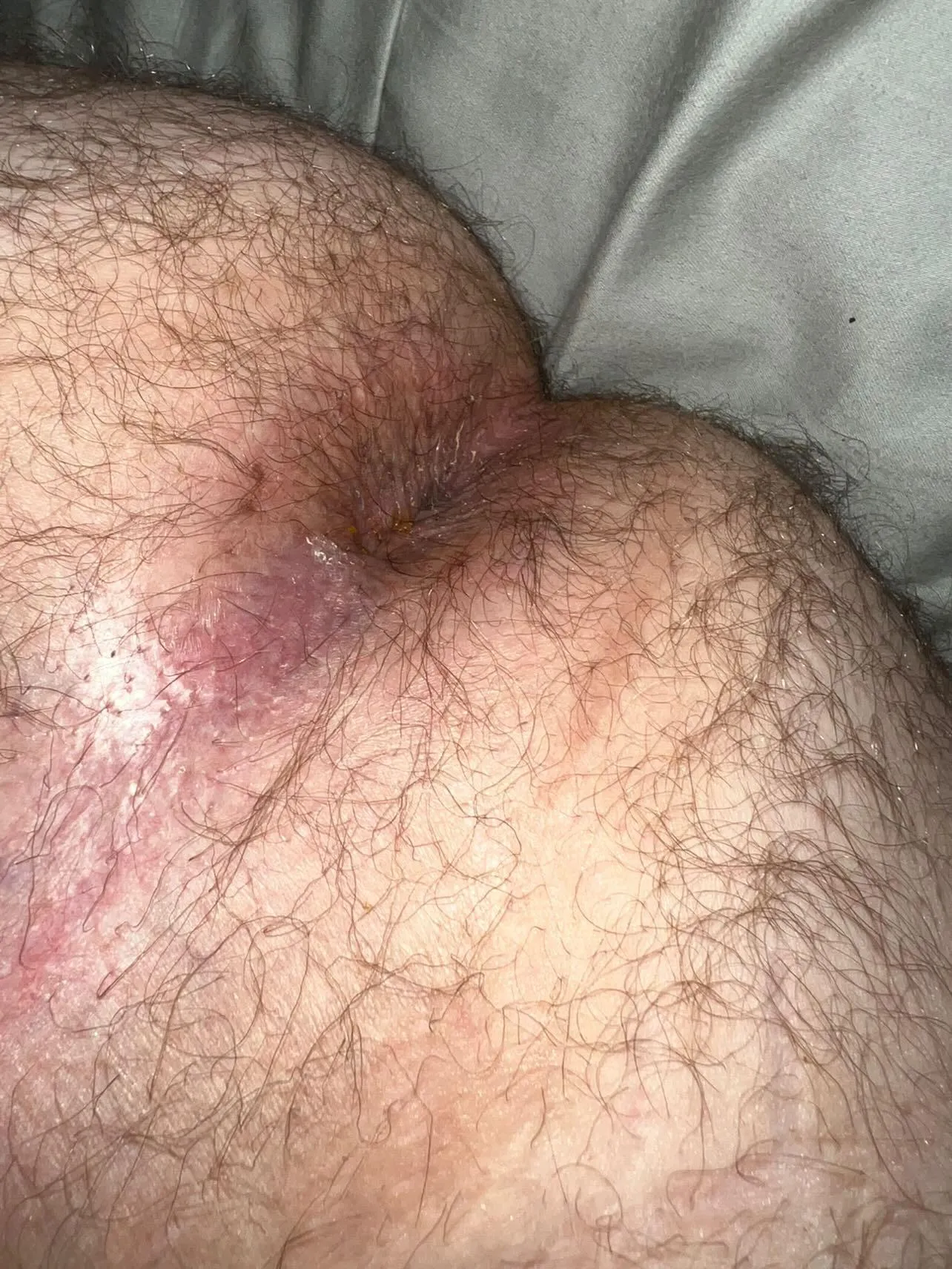 Airing out (nsfw)