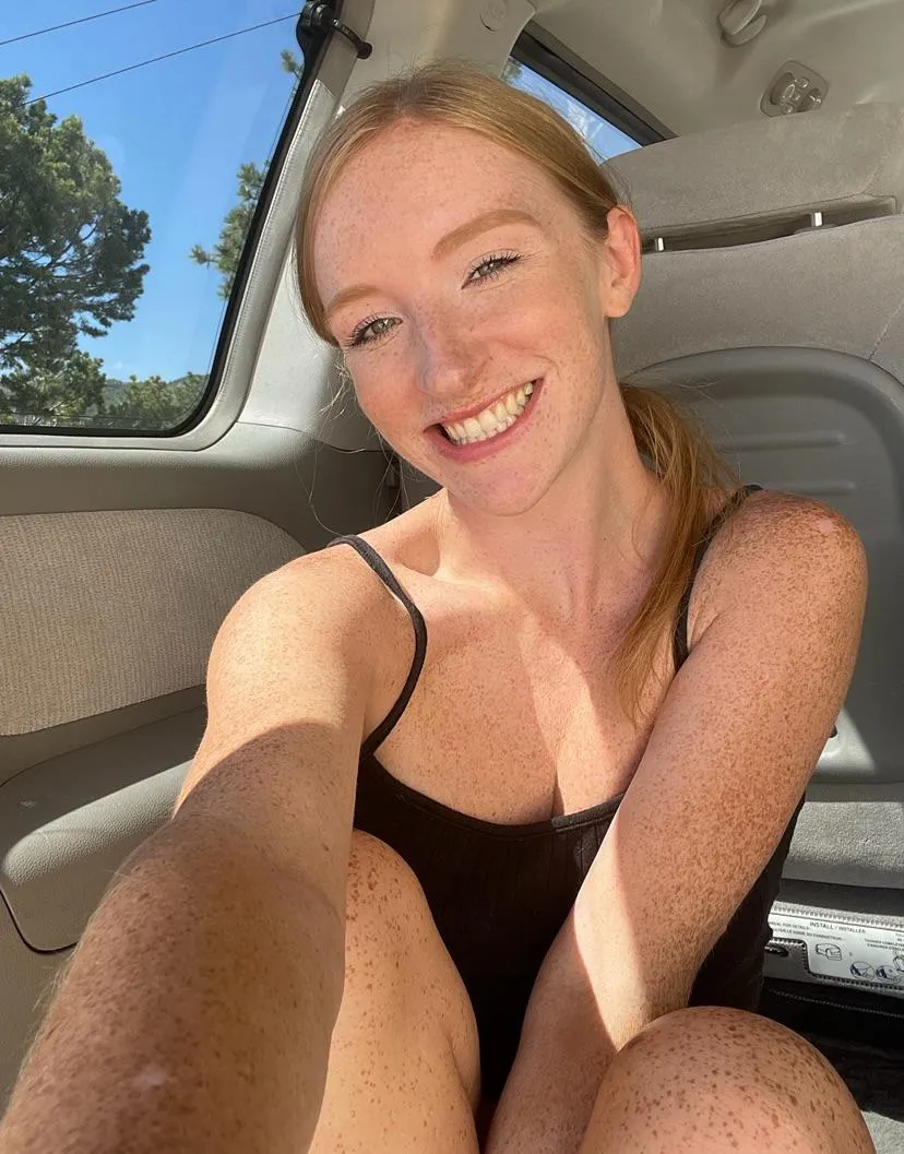 Do you think freckles are sexy