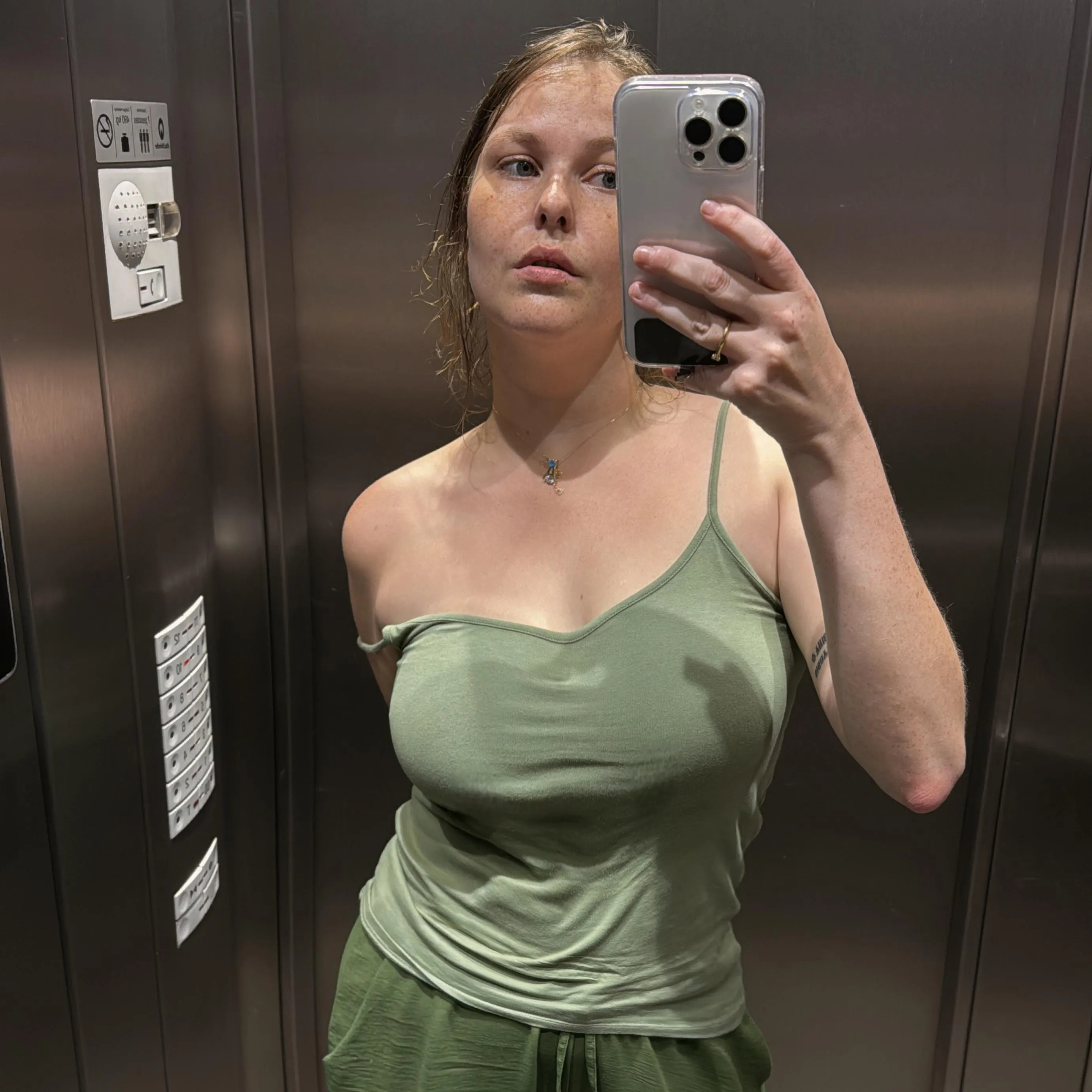 Maybe you can’t see but the freckles are all over