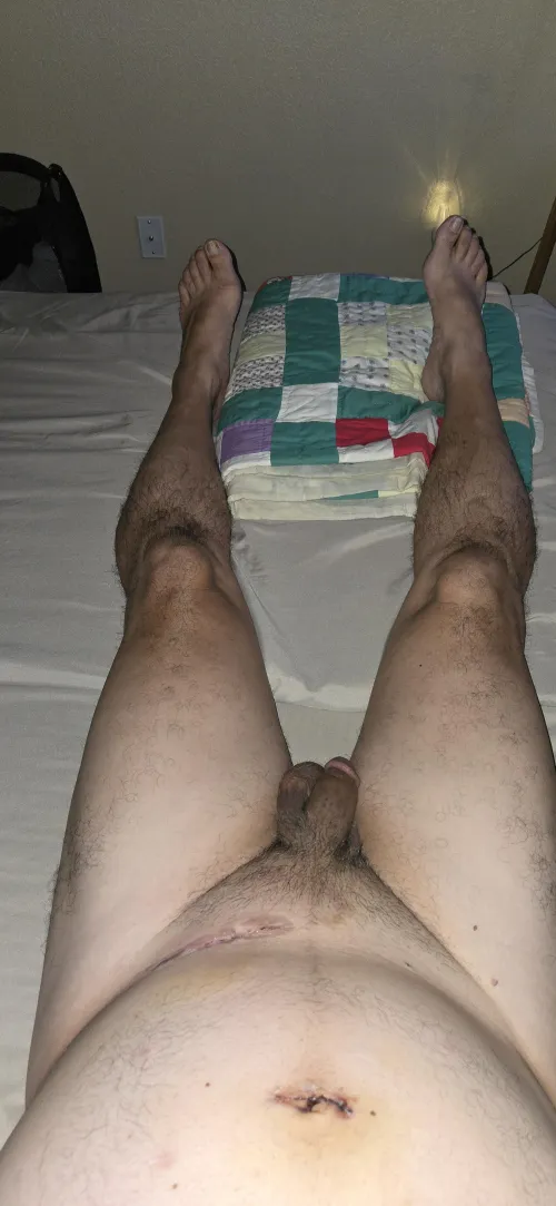 How I sleep after my double hernia surgery. Still painful.