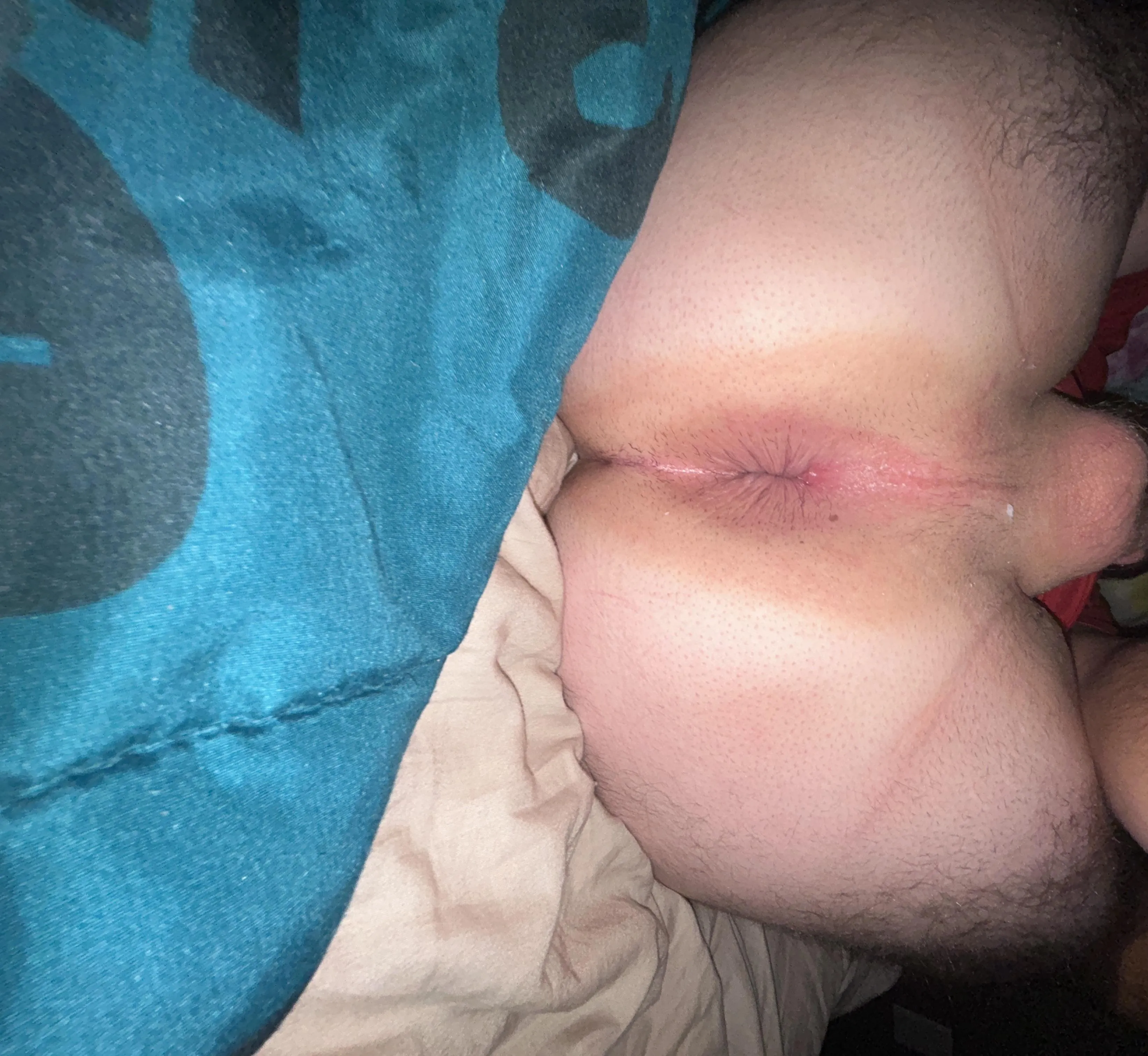 So tight it’s closed