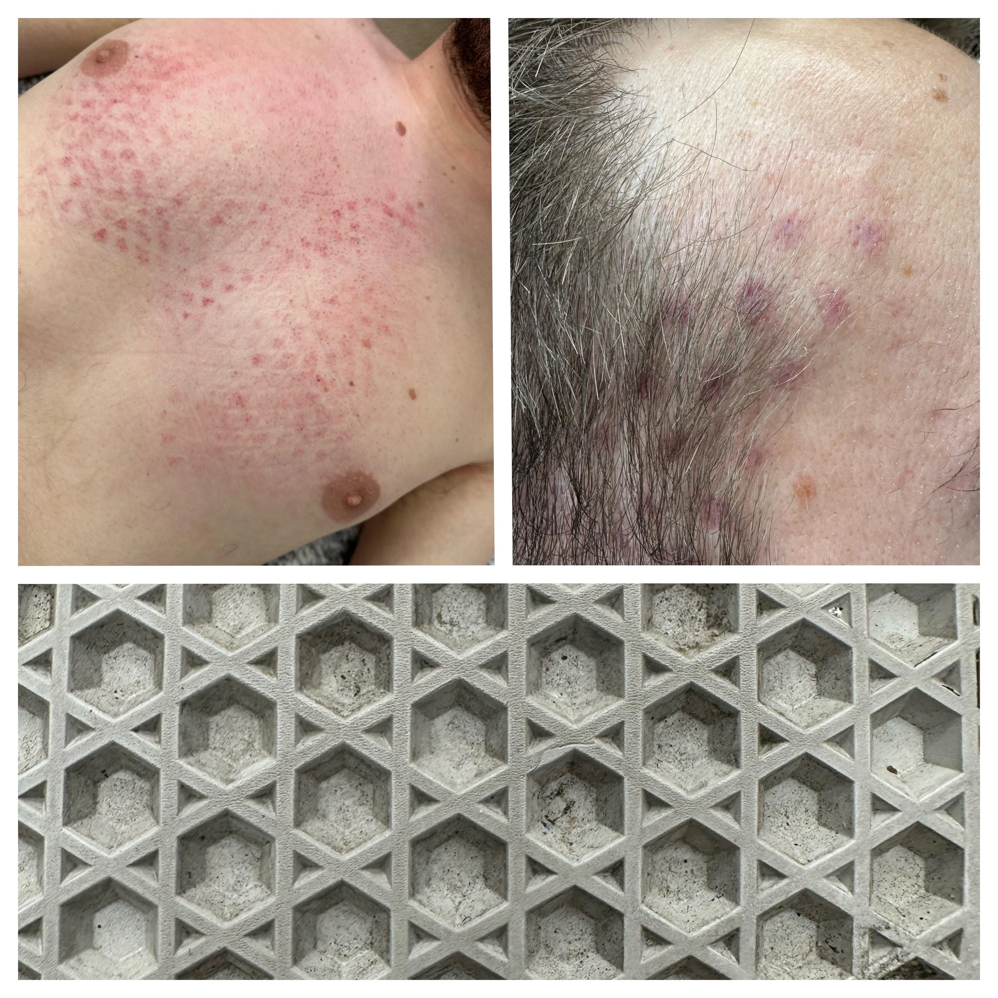 Trampling him until he has bruises all over his body….