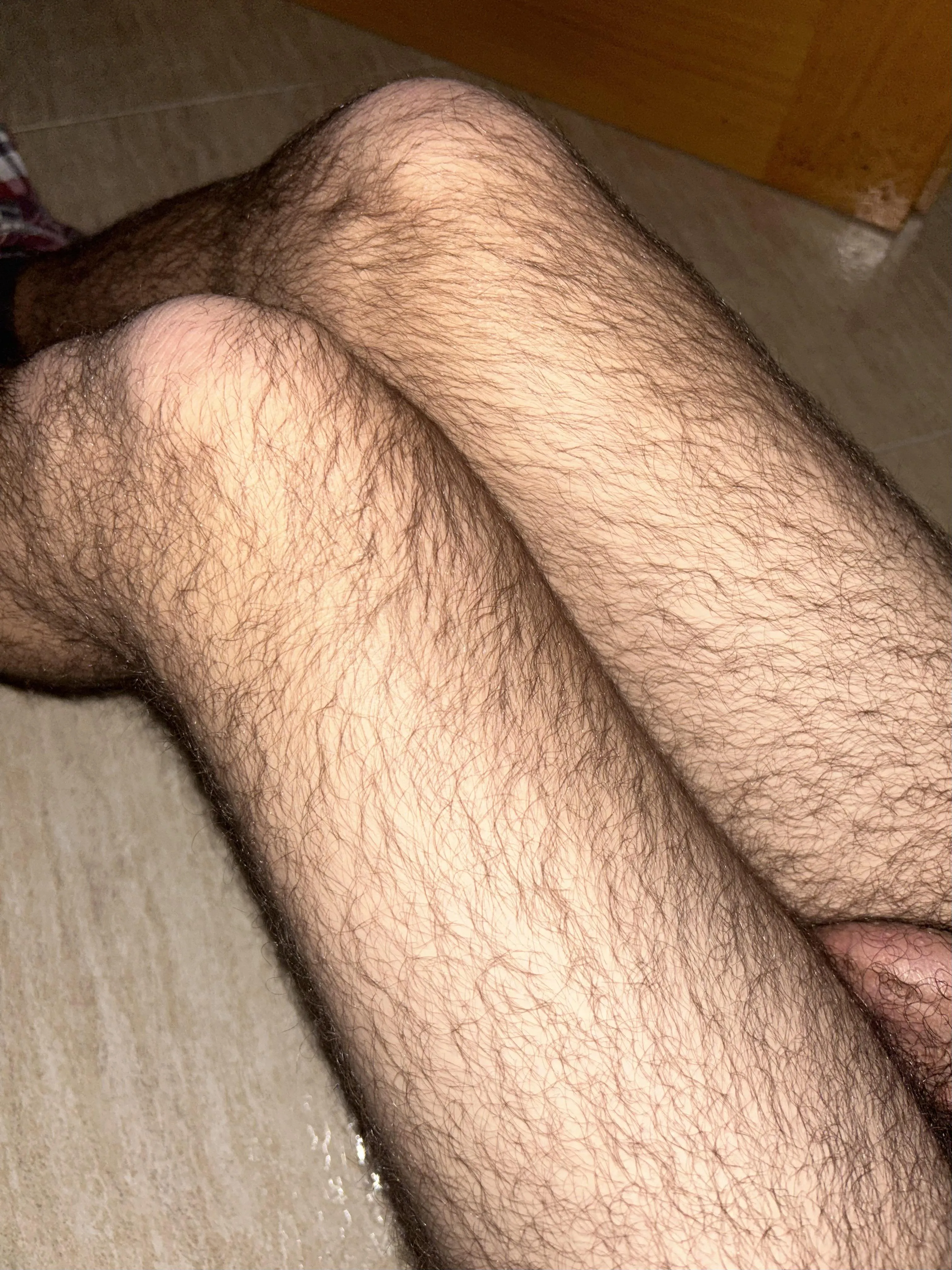 Are my legs too hairy for a 19 year old?