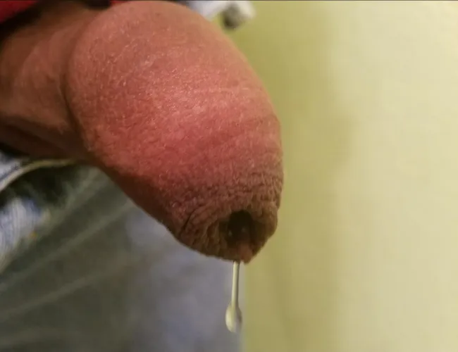 Leaking out of my overhang 💜