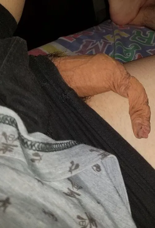 What would you do if this is poking out while watching tv?