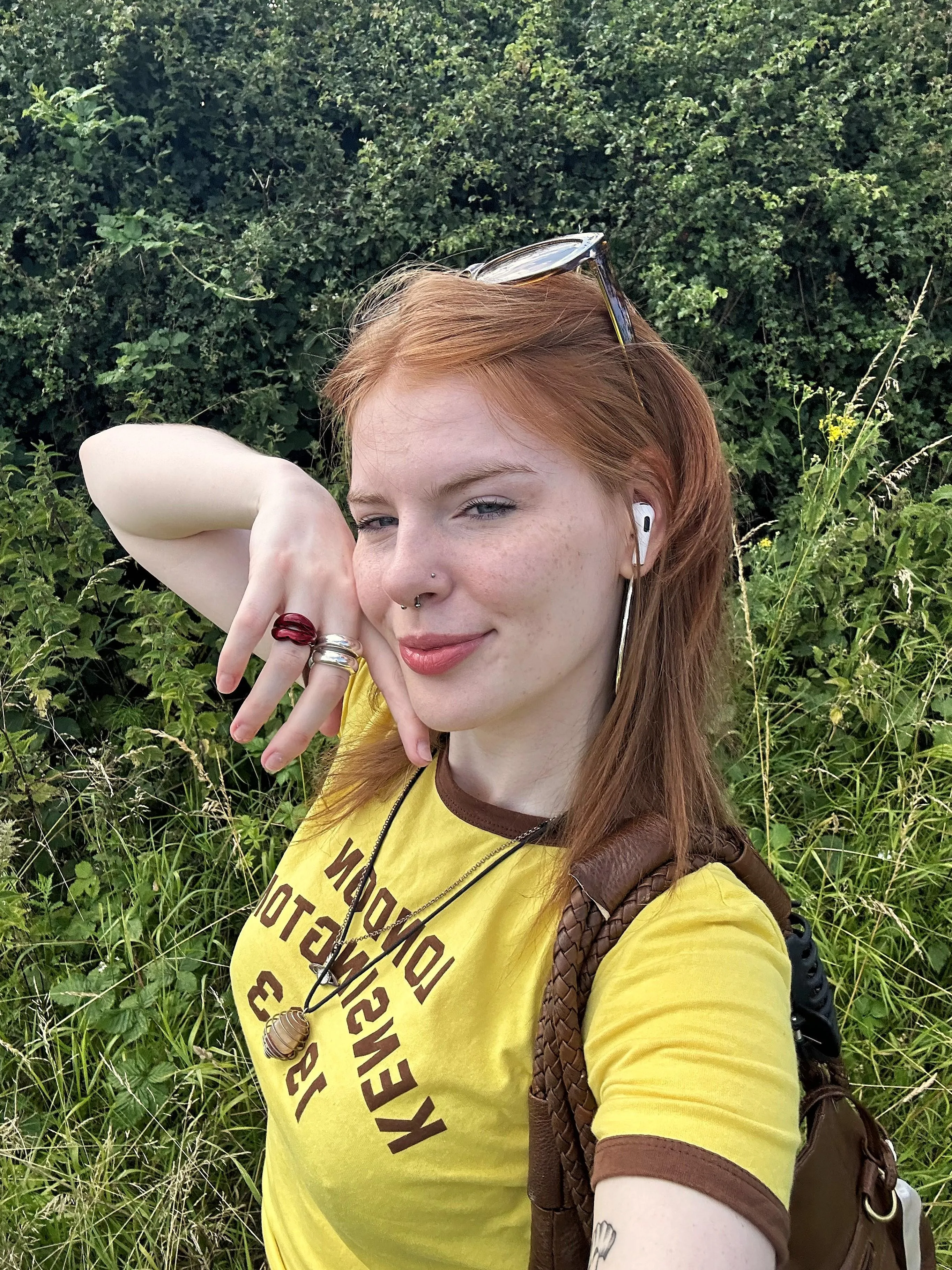 My freckles makes me glow[IRTR]