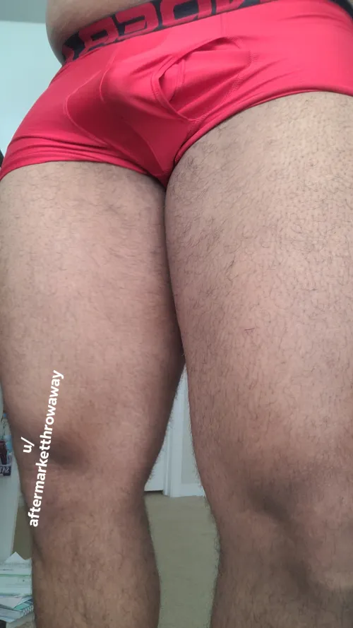 Cat Scratched Me. Does it look bad?