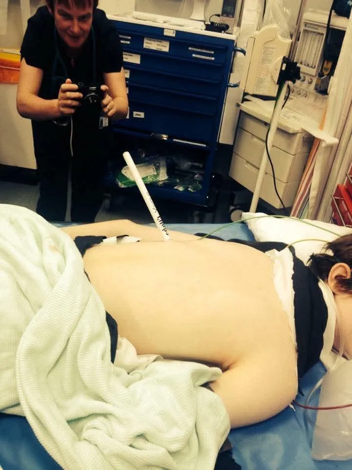 I got impaled on a drumstick.