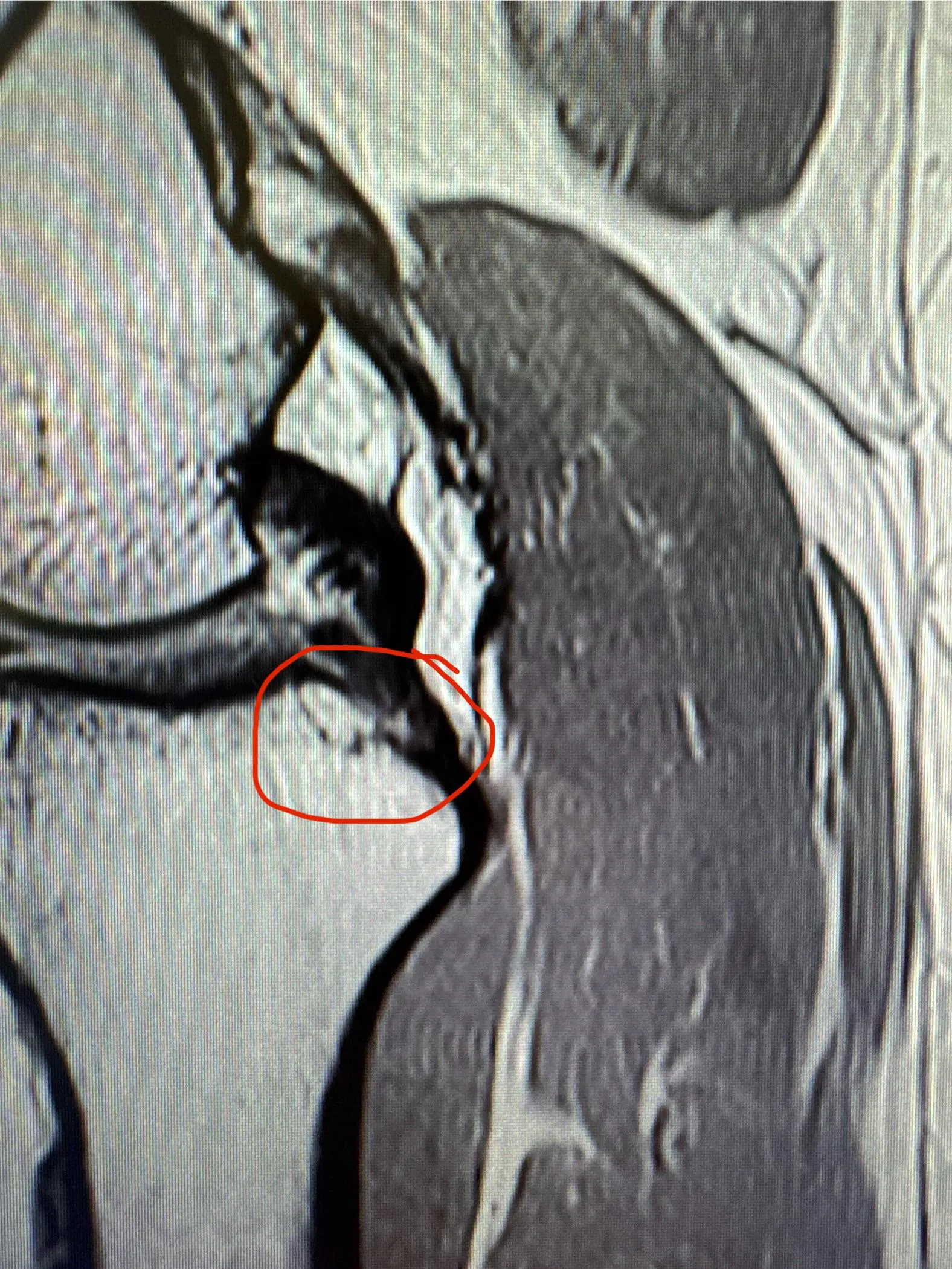 Is this a fracture?