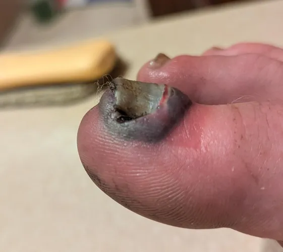 Trailer ramp dropped about 12 inches onto it.