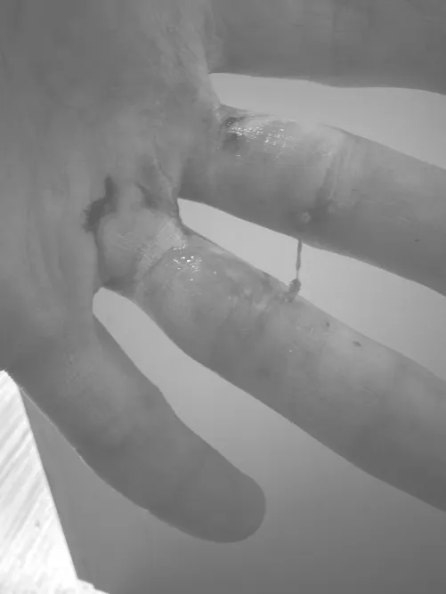 Anyone into really nasty snot/booger/used tissue content? Would love to talk and fulfill filth fantasies….