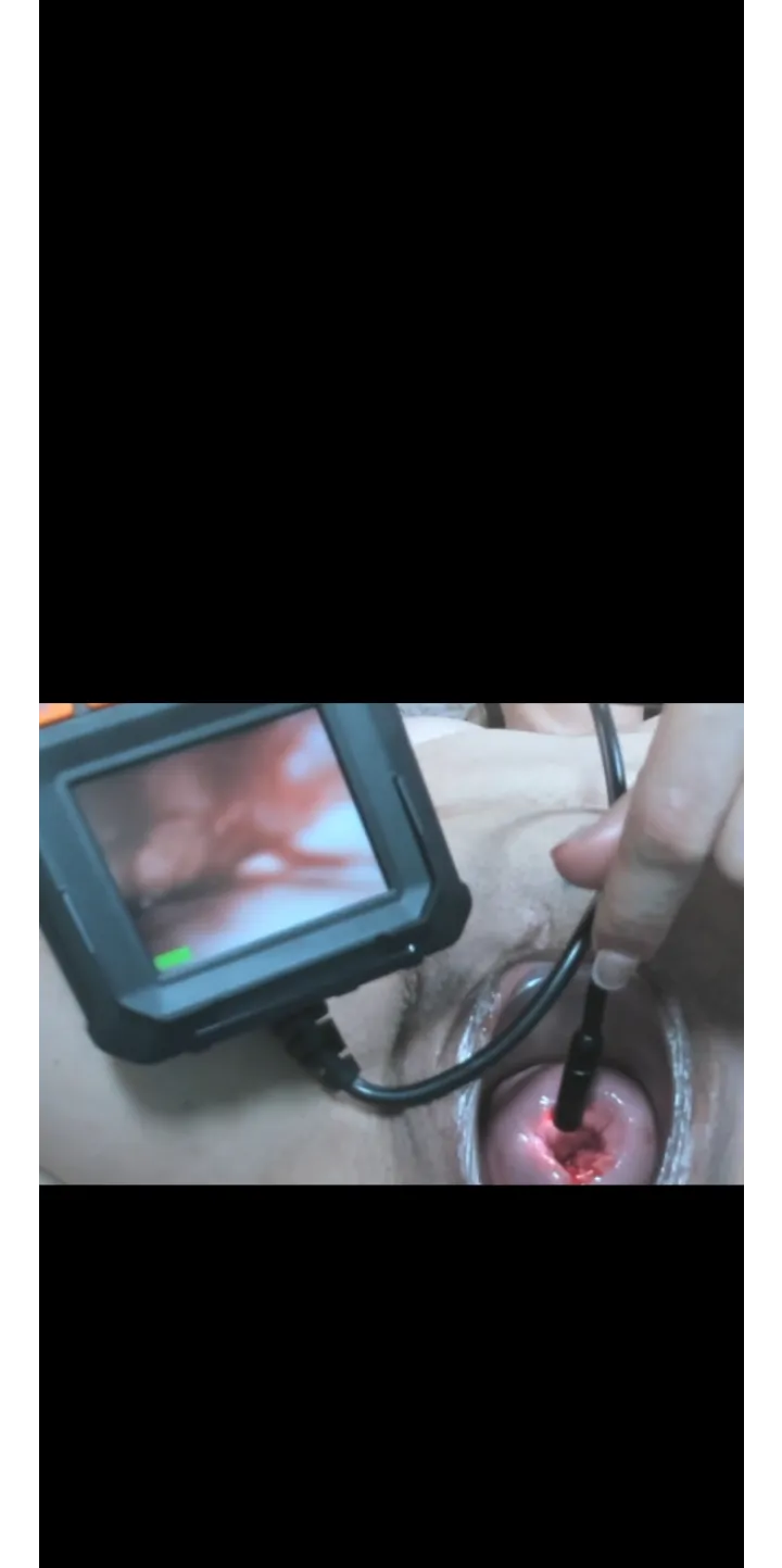 Cervix in HD