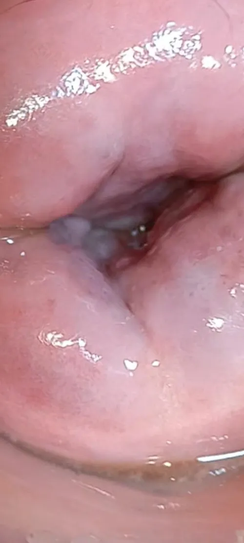 Cervix para fetichistas