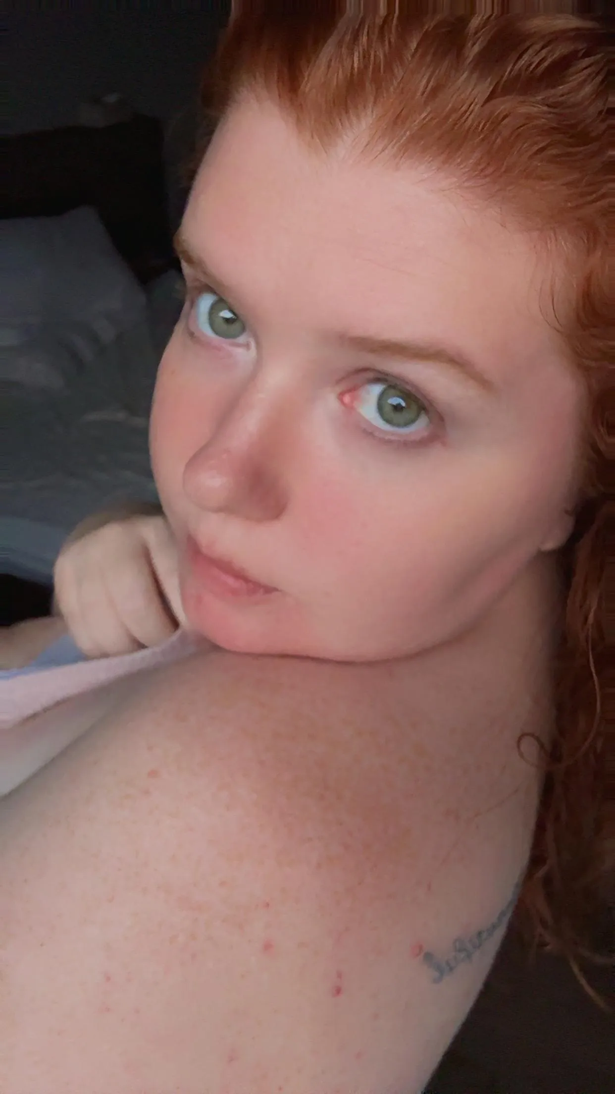 Do shoulder freckles count