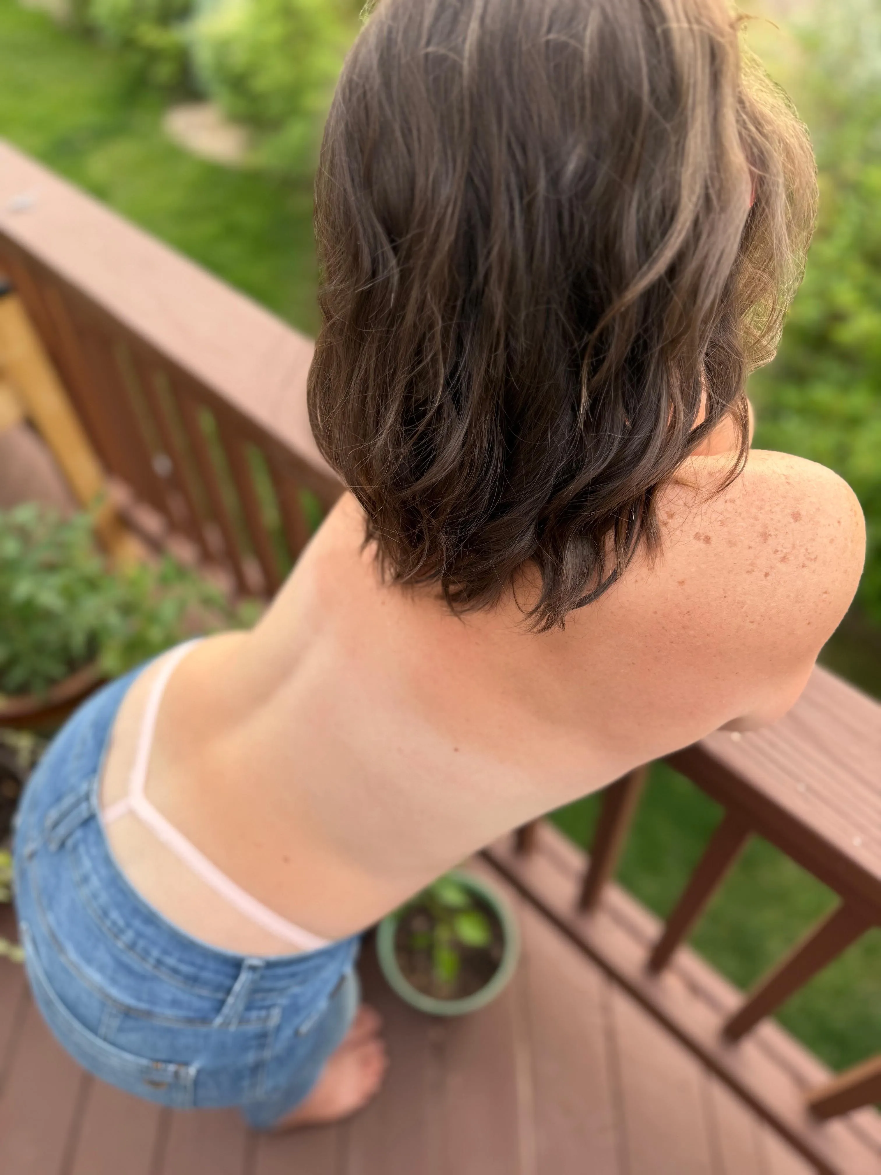 Just a few of my well earned freckles