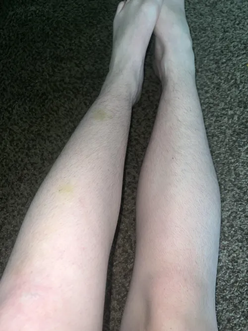 People are starting to notice how hairy they are... should I care?