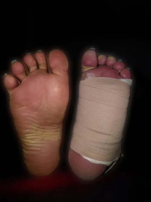 Would the bandages on my paralyzed and swollen foot prevent you from using it for your pleasure? 😘