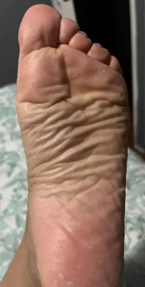 Here's your Sunday Soles. How many wrinkles do my tiny feet have