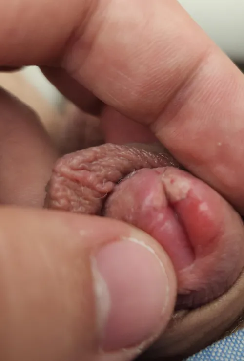 Is this white spot normal?