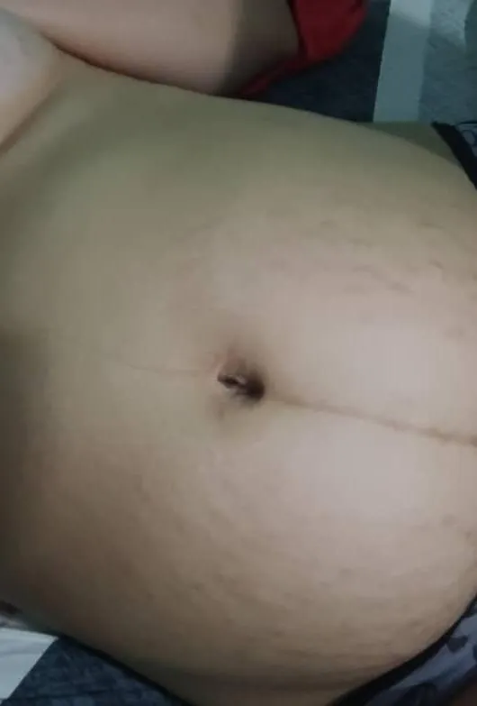 Do you like stretch marks on pregnant women?