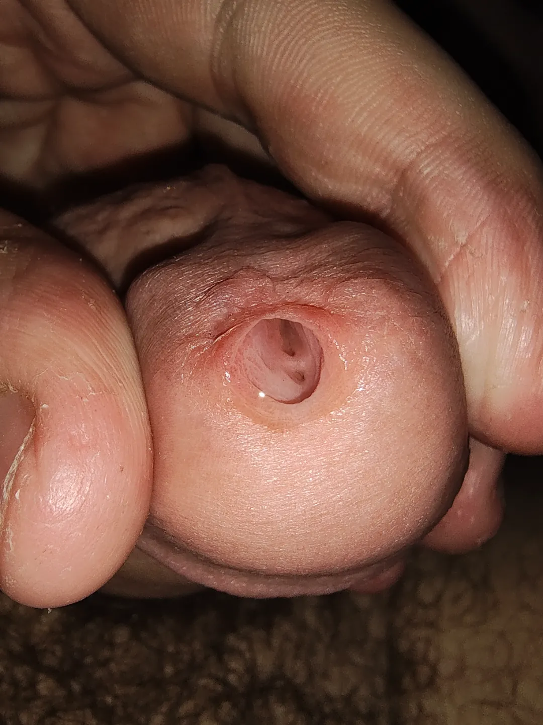 Found out I have two urethras the other day