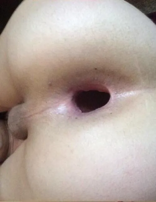 Kapios megalos na me skisi?