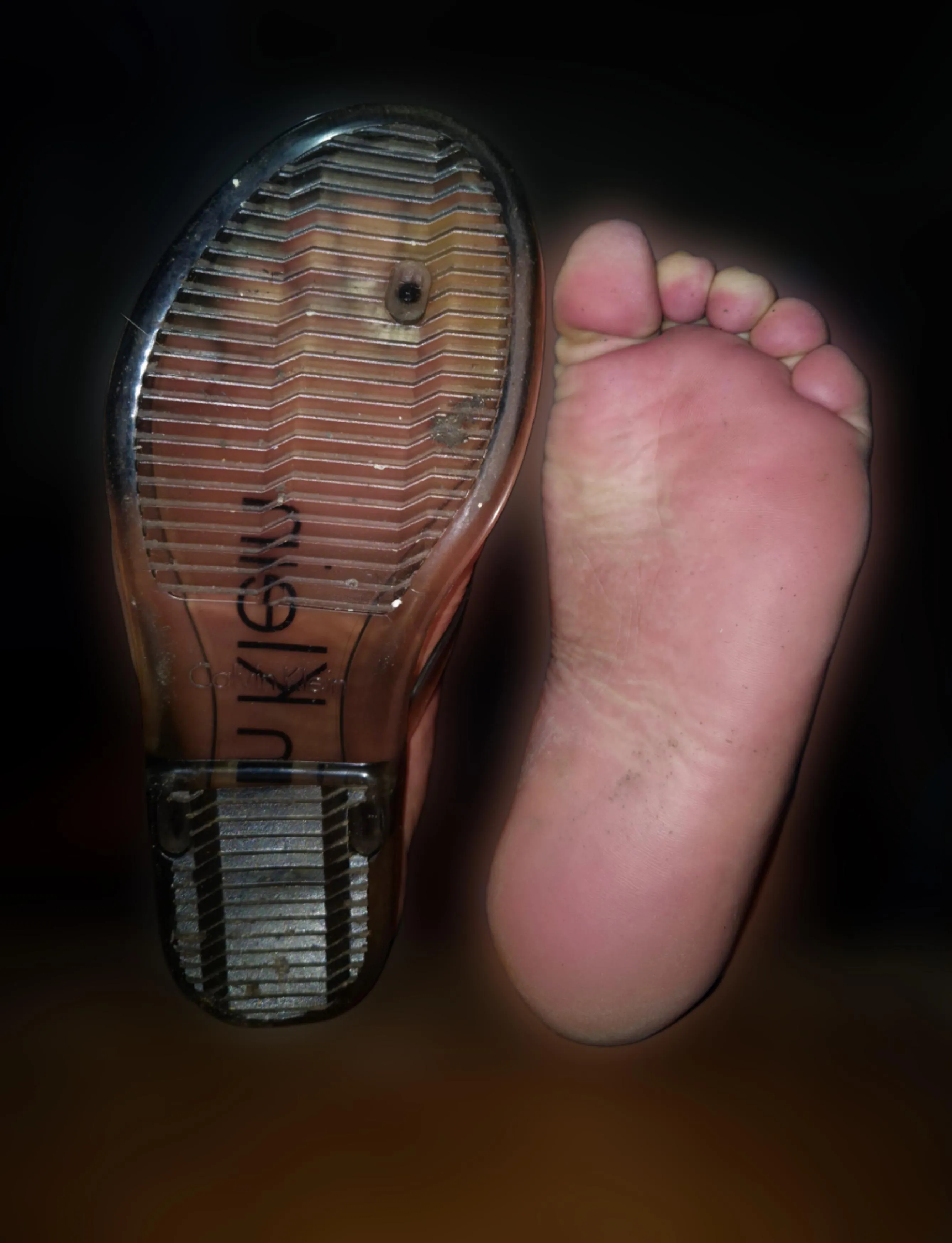 My paralyzed foot is soo useless i can't even put a flip flop on it 🫠