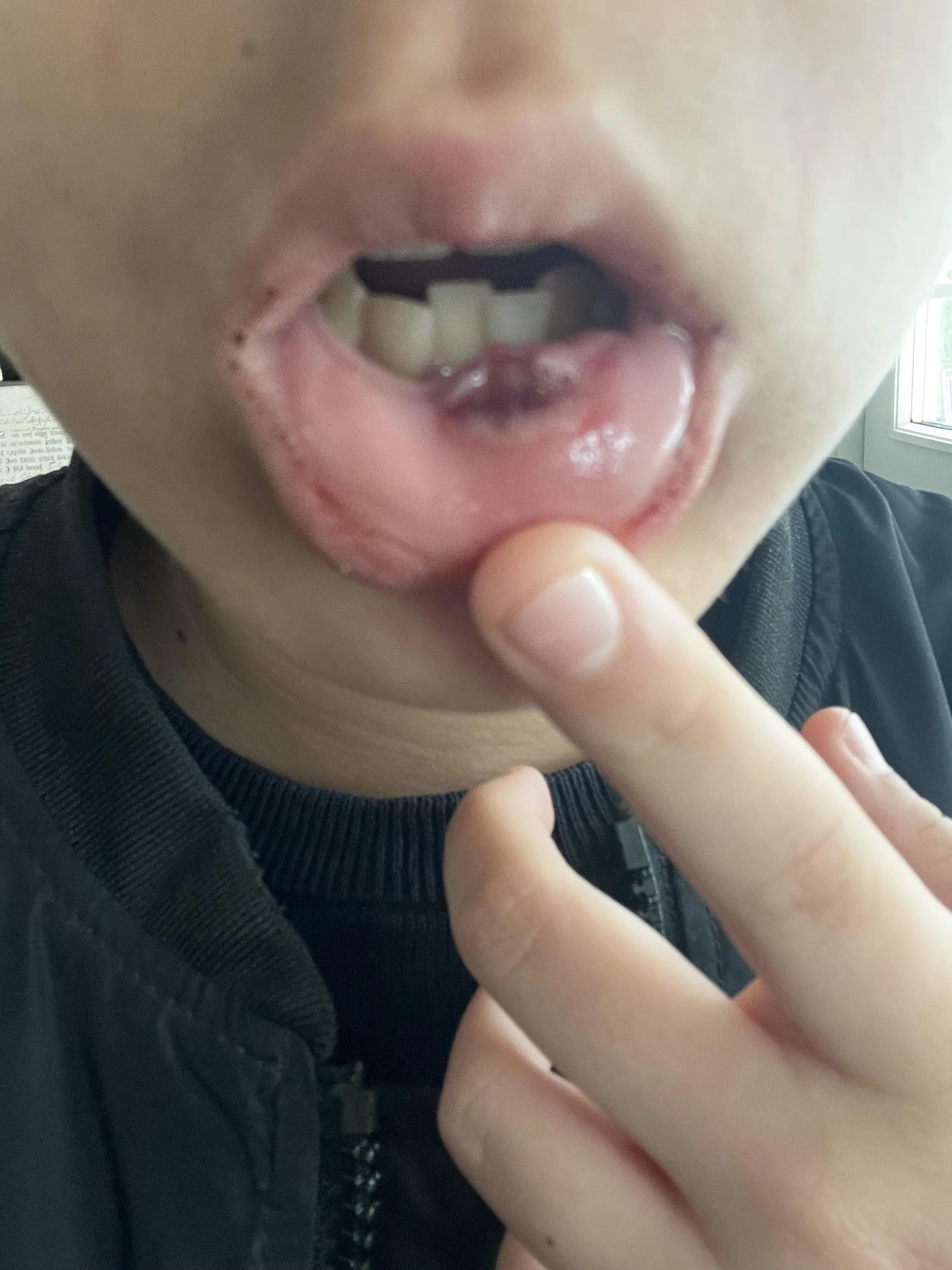 Guys is this bad? I fell and busted my lip pretty hard.