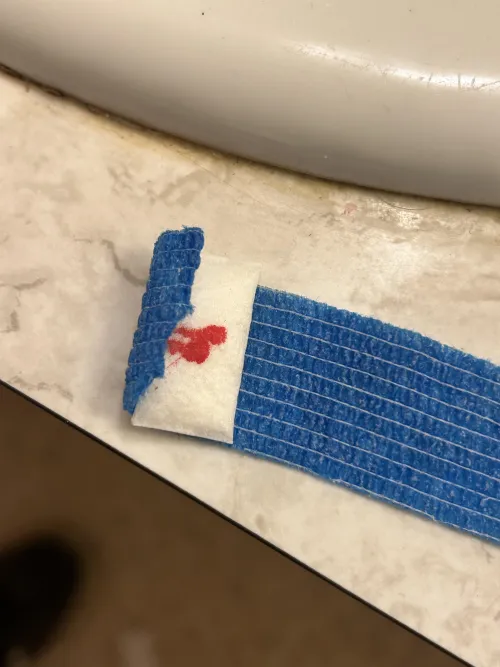 Out of gauze, used a Zyn