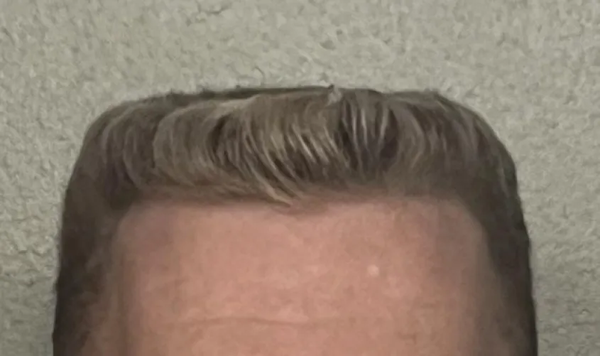 Here’s my flattop