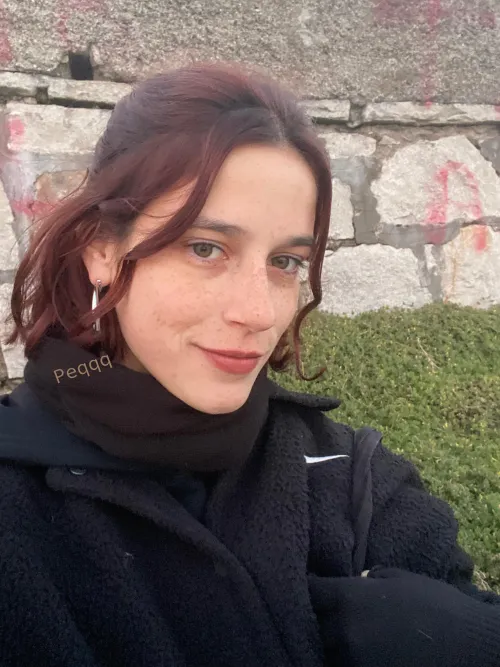 My freckles on a gloomy day [IRTR]