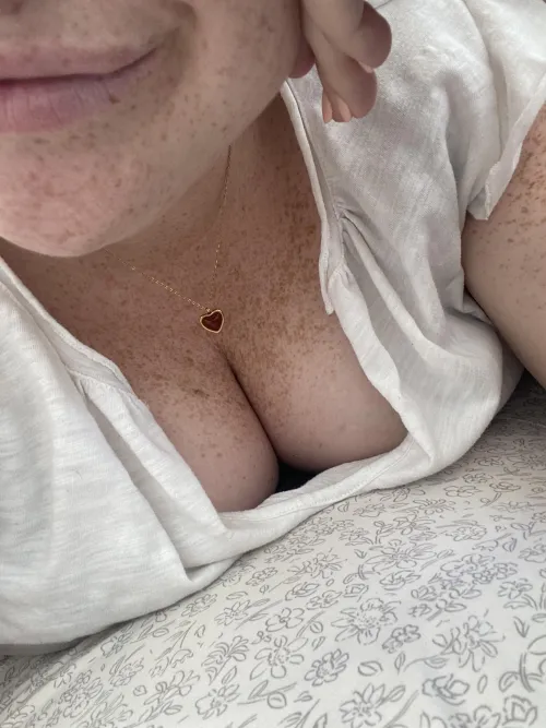 My freckles are really popping this year