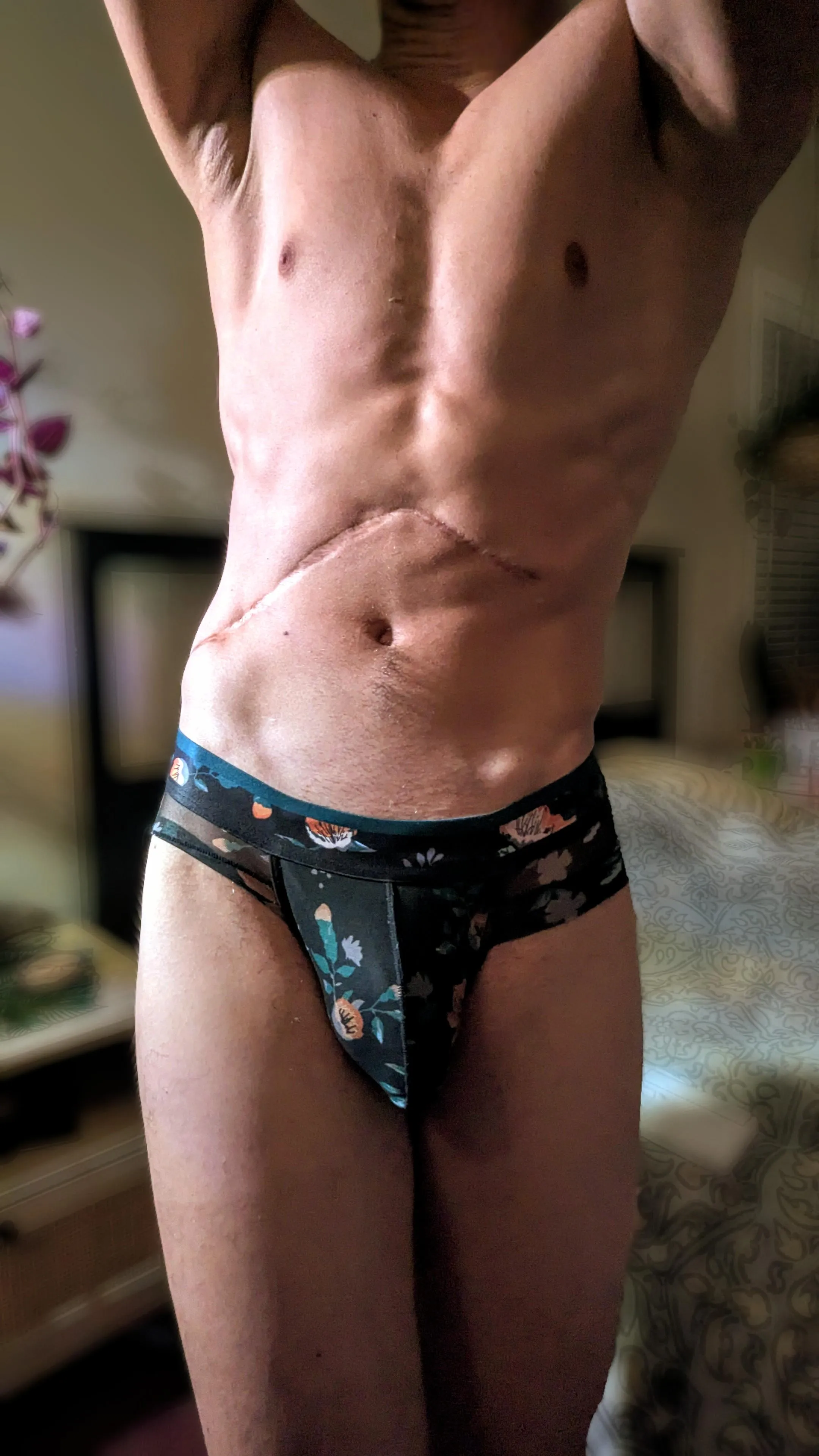 The scar doesn't bite... I do.