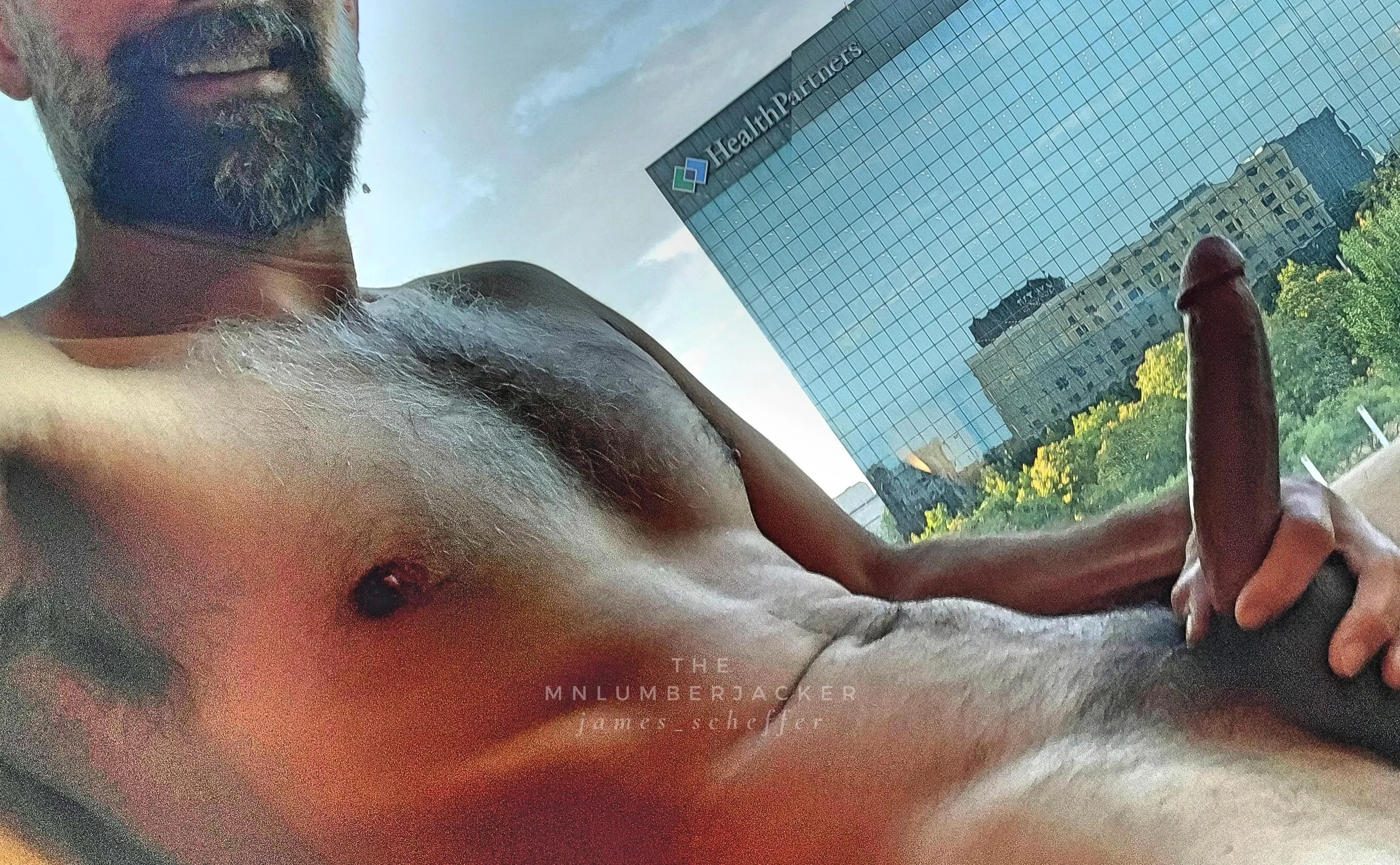 hanging out for everyone to see