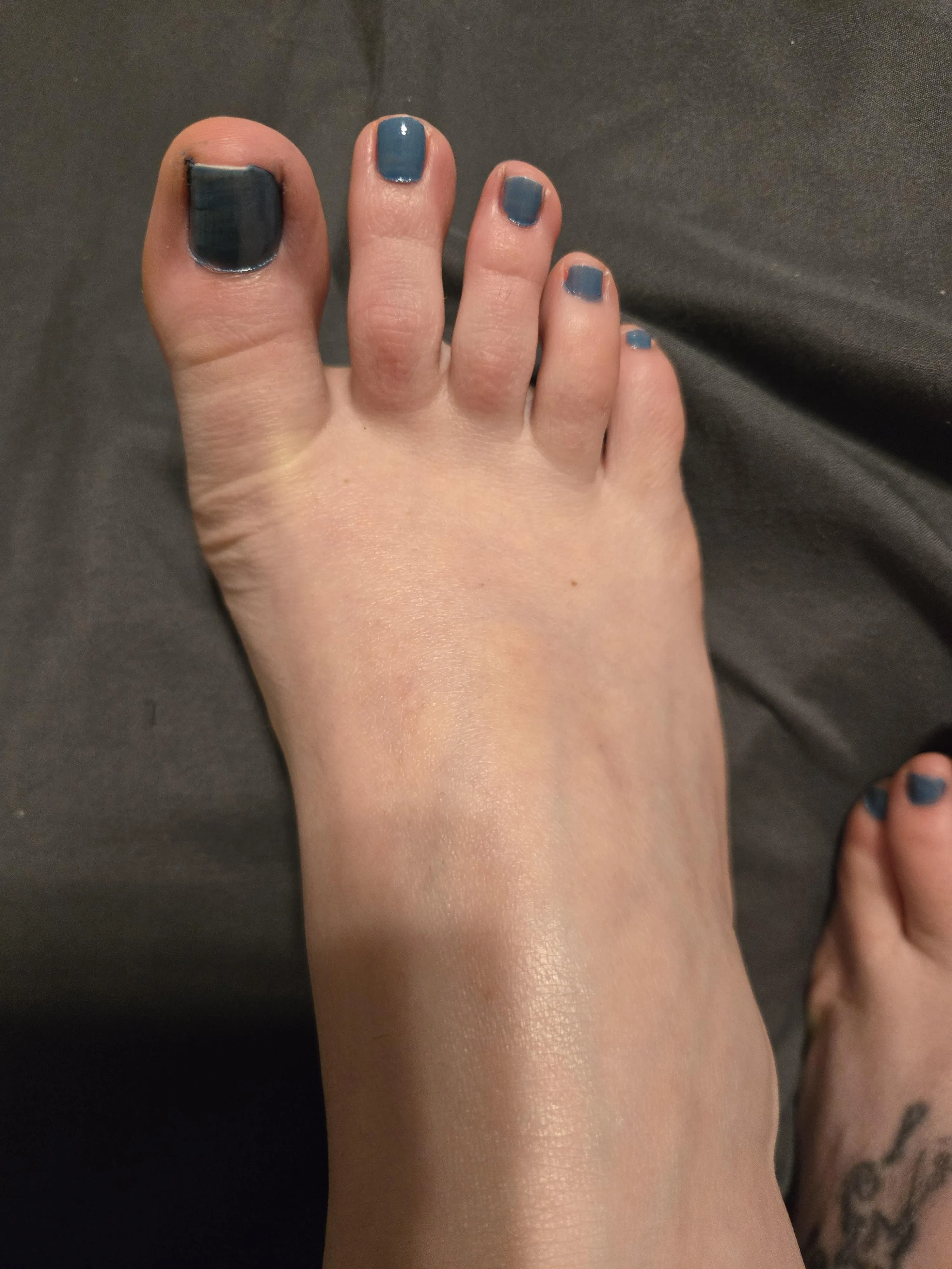 Married nurse feet, what would you do with them