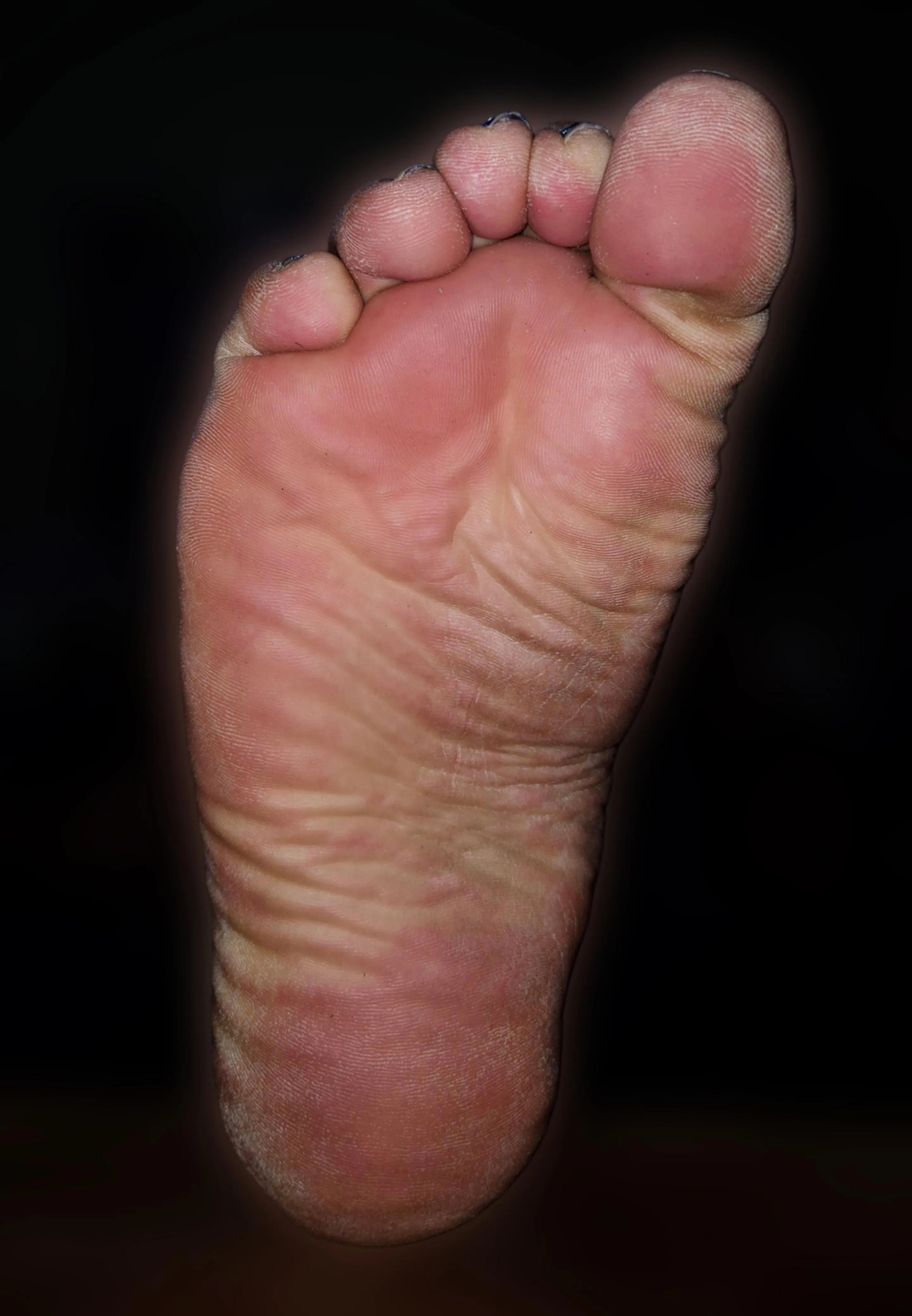 Decided to use a foot mask to make my feet smoother and it just made them look even rougher 🫠, i should just stick to more natural methods i guess 🍆💦