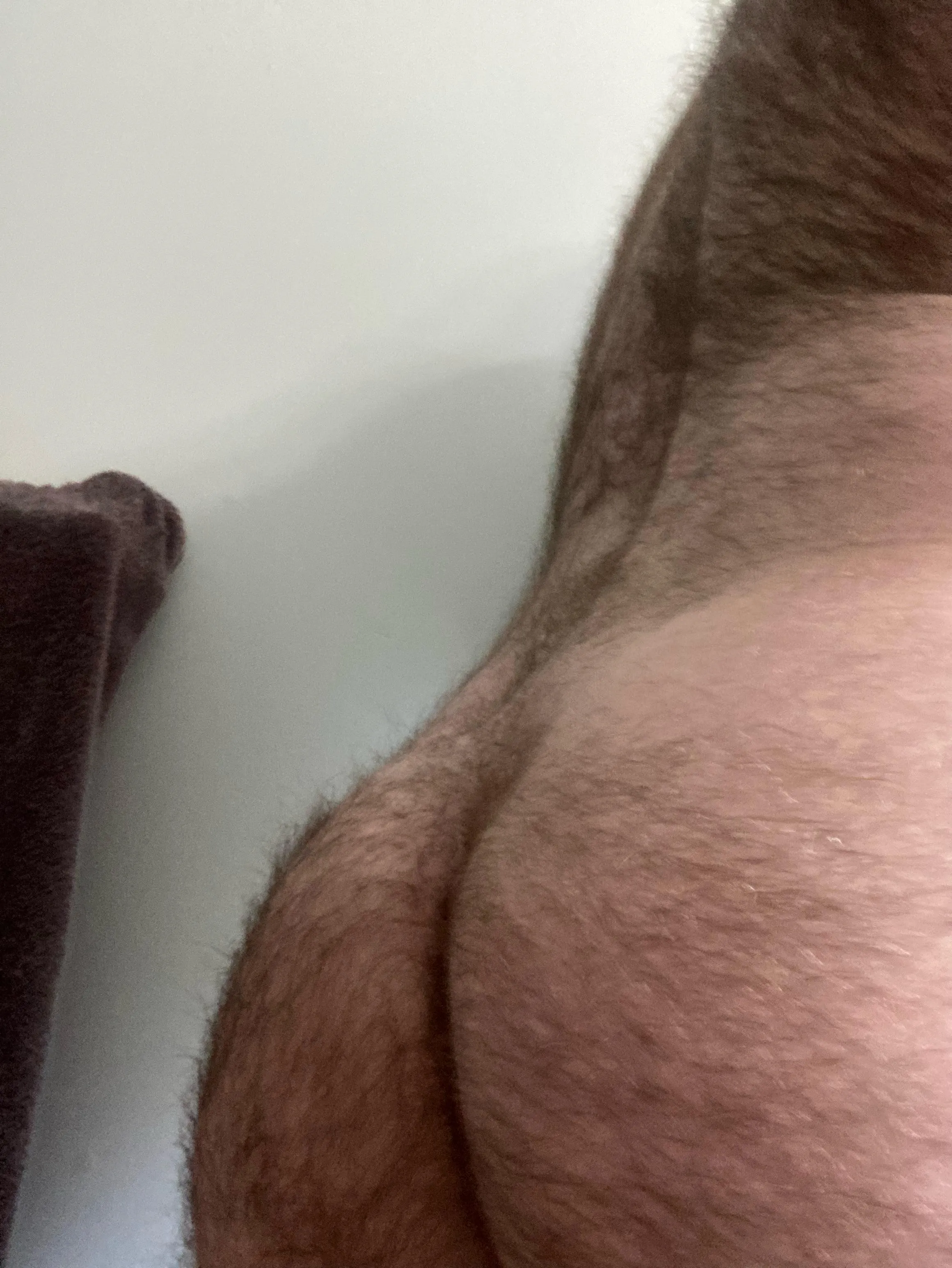 Hairy cheeks