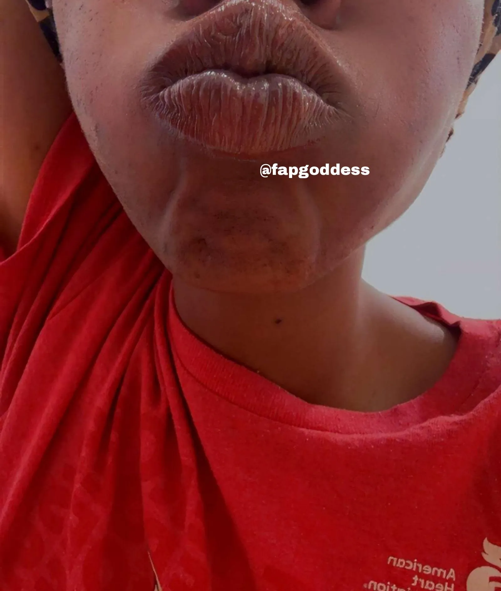 Someone suggested fish lips? Should I try that next?