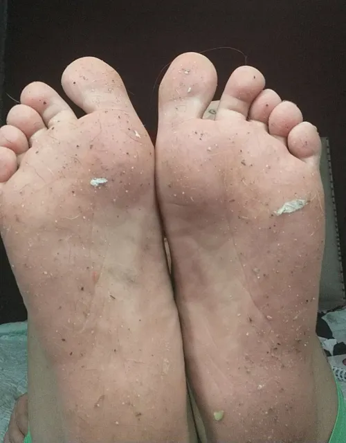 Street feet, dark fantasies