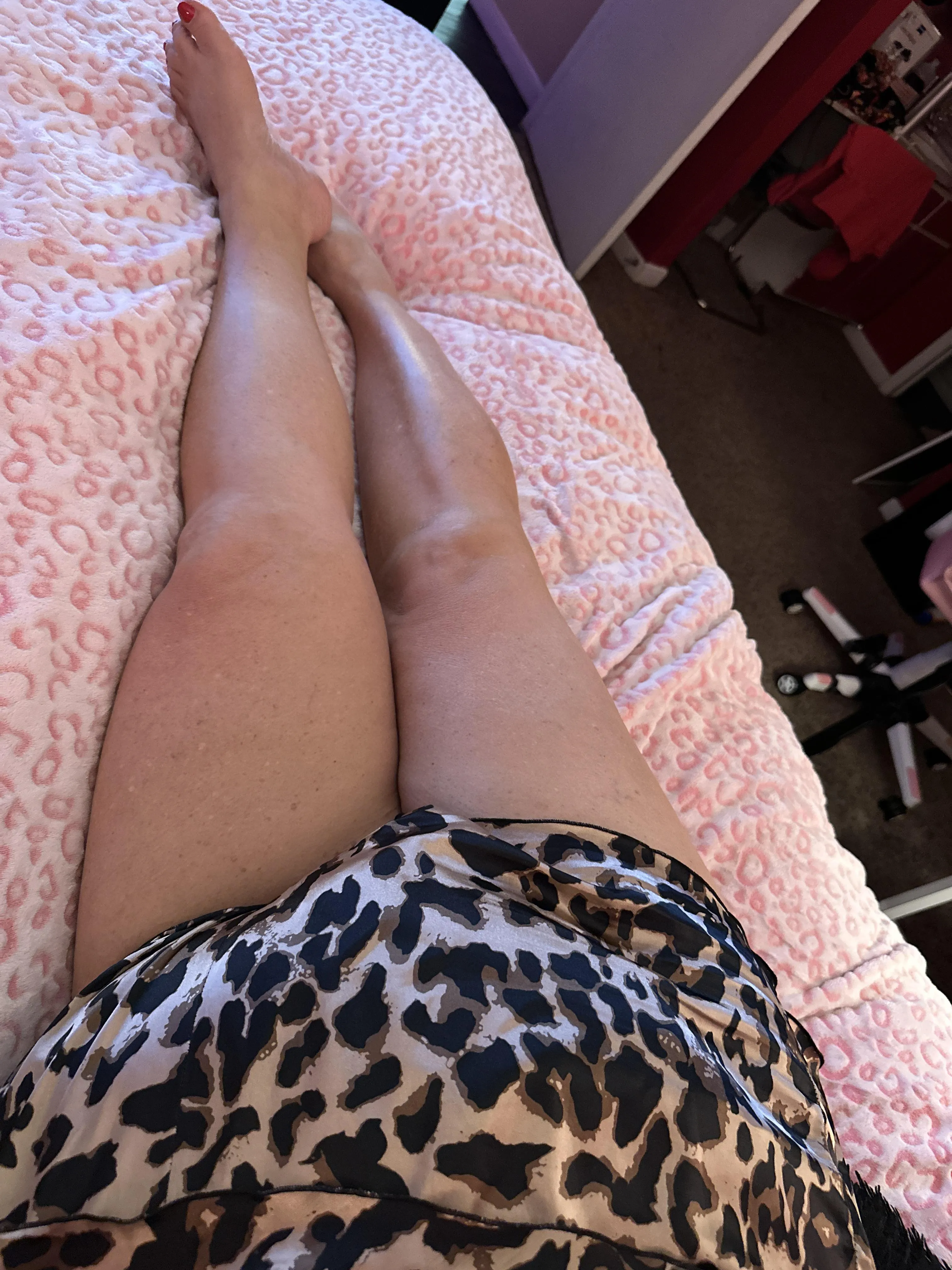 Would you kiss my stretch marks or pretend they weren’t there?