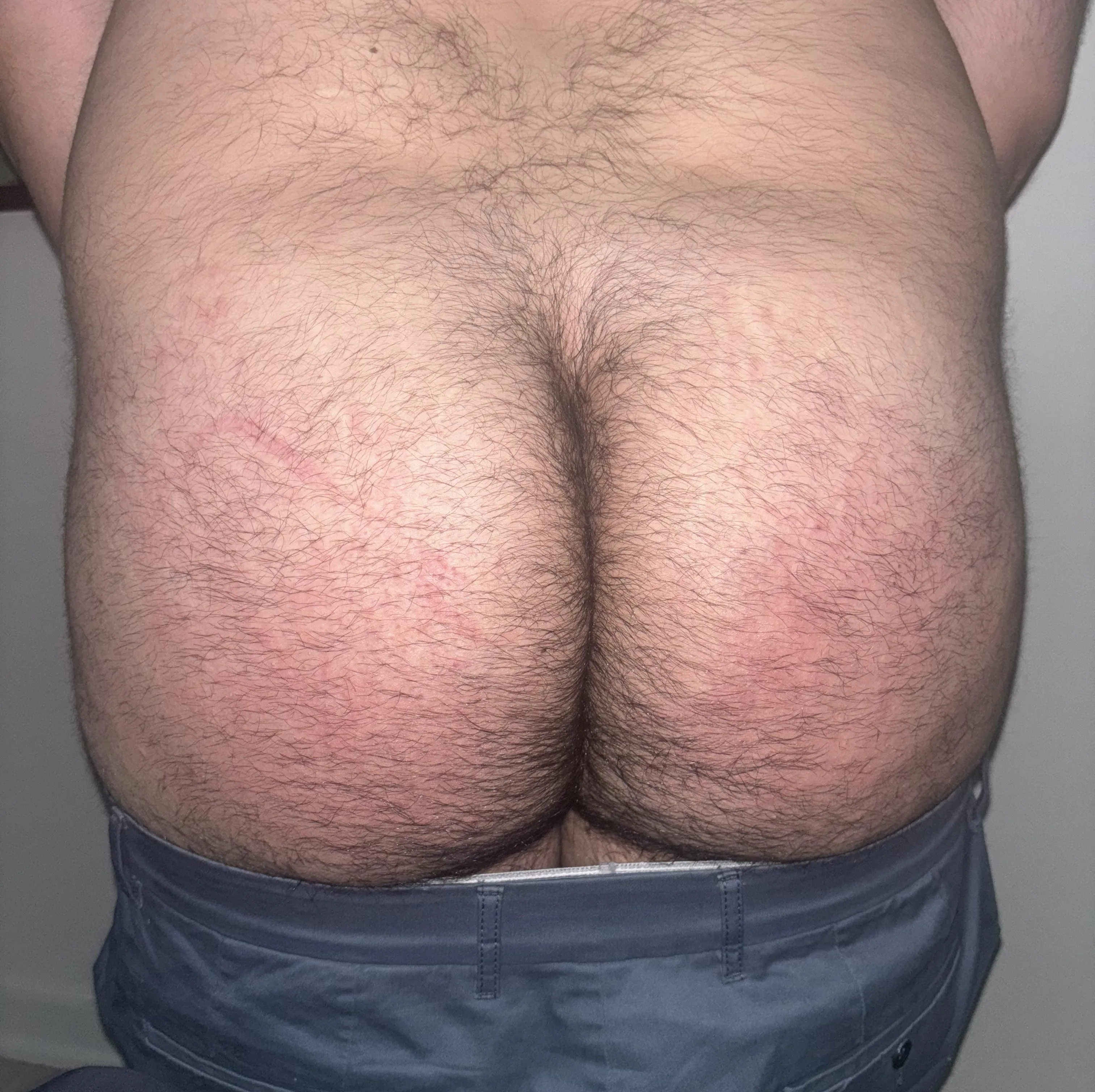 beat his ass with a coat hanger!! 🤭