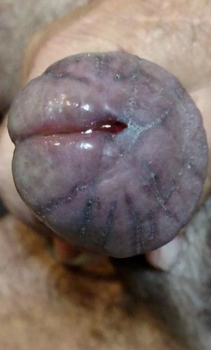 CMessed up cock gead5