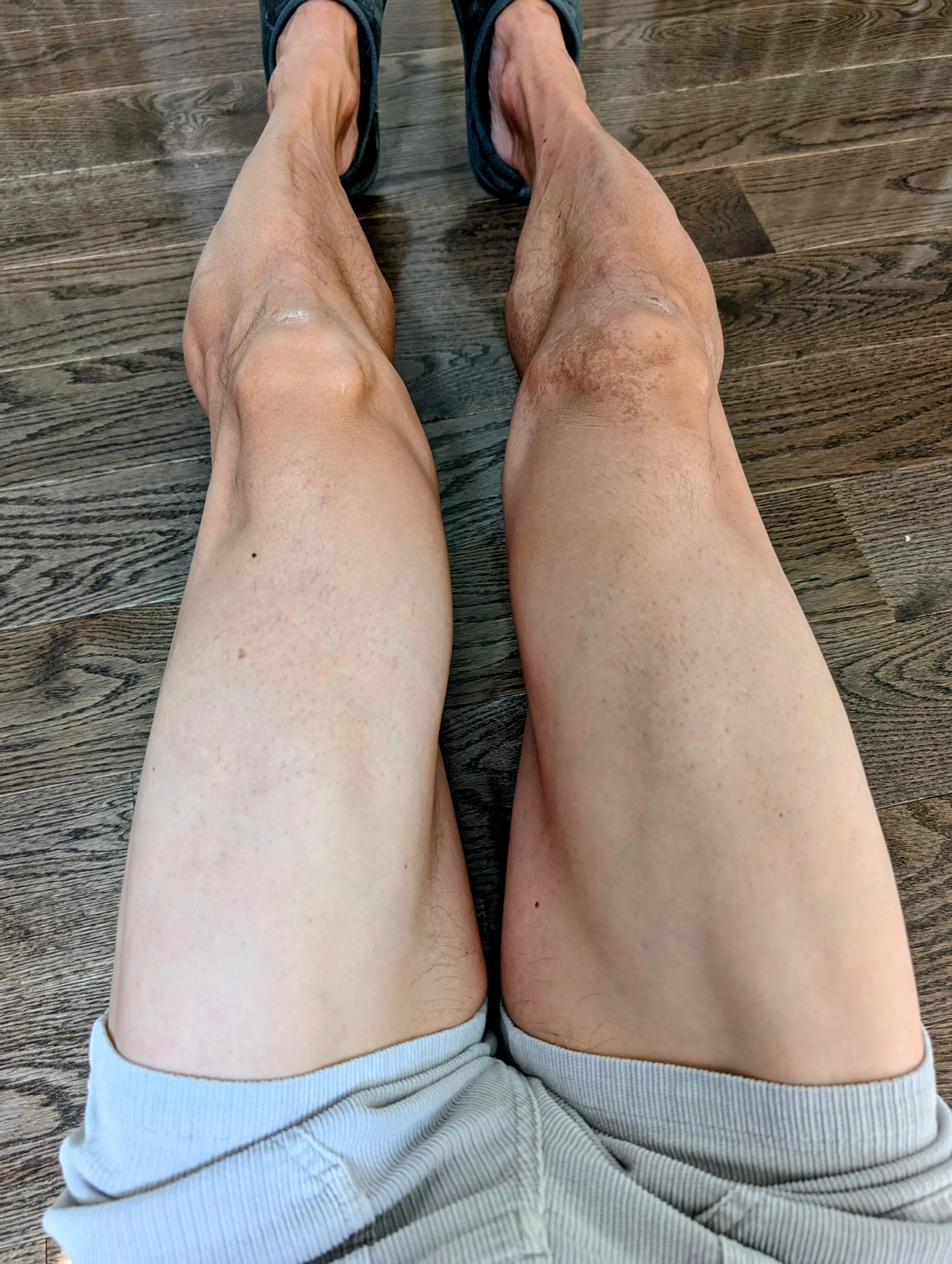 Gotta even out this tan