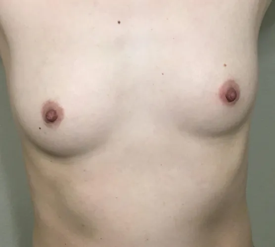 41F, 5’2”, 115lbs Asian Mom