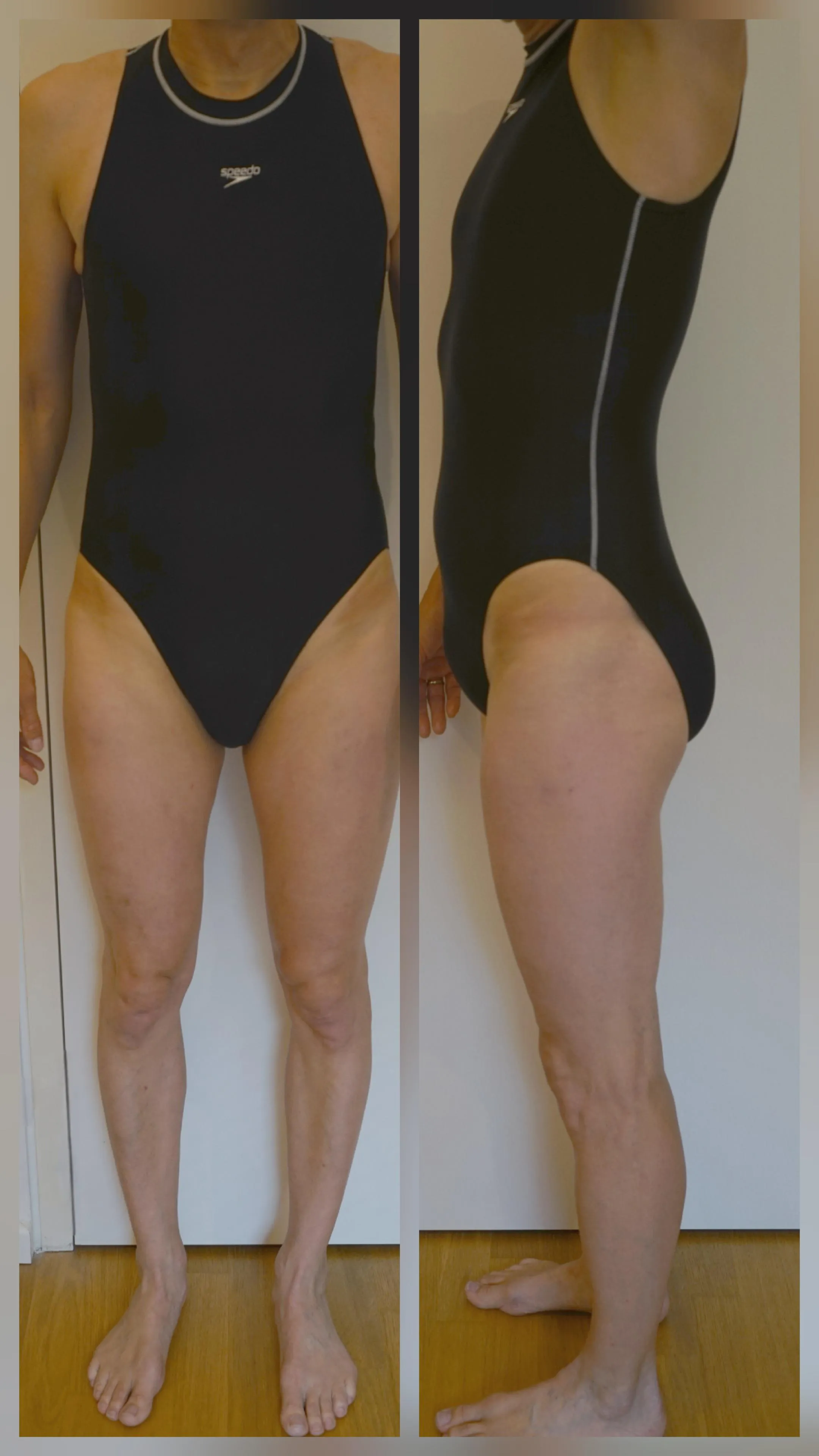Speedo Hydrasuit