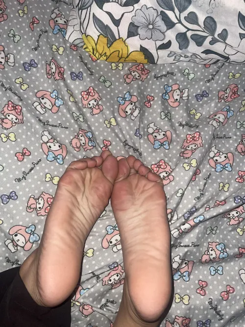 Crusty feet!! Dm me😝