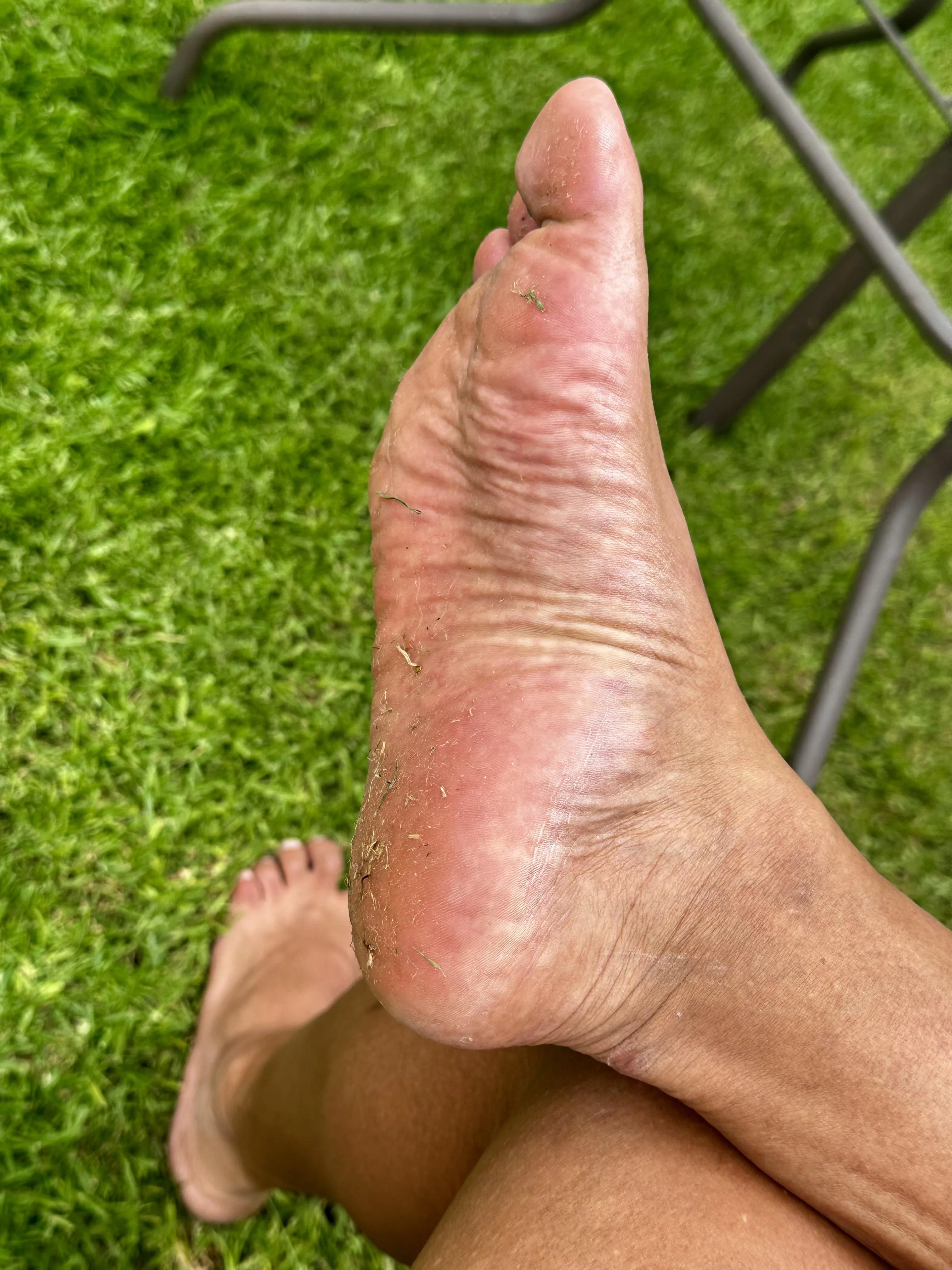 Dirty and smelly wrinkles